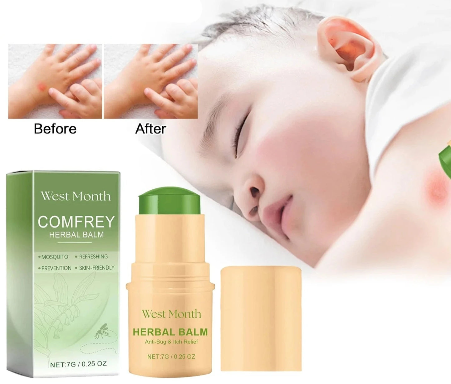 Baby Mosquito Balm Soothes Itching